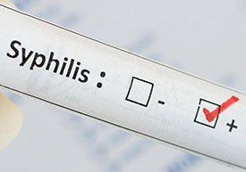 Сифилис – симптомы, причины, фото и лечение сифилиса